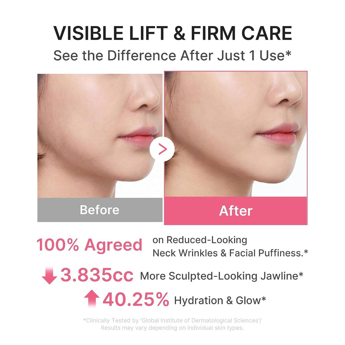 MEDICUBE PDRN Gua Sha Neck Wrinkle Cream
