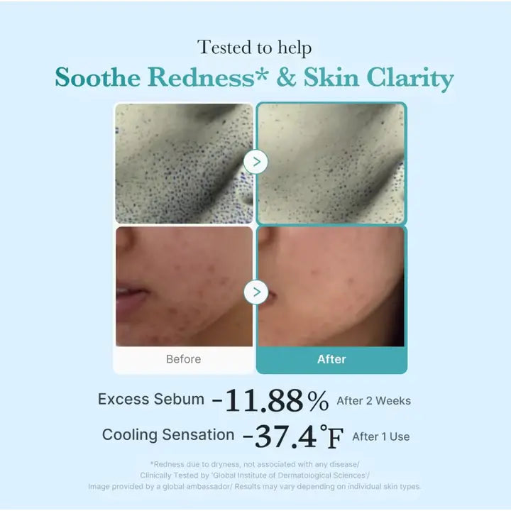 Medicube Azelaic Acid Niacinamide Clear Toner