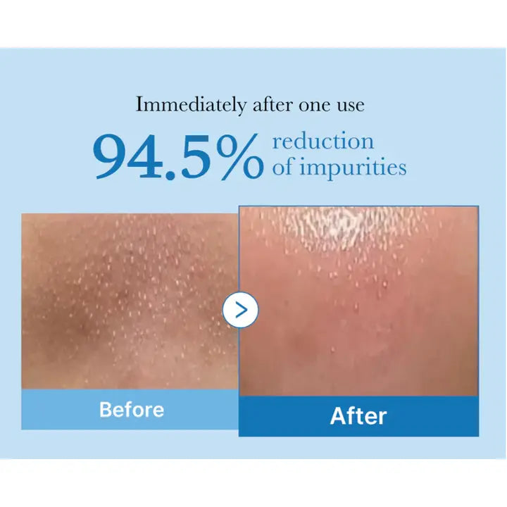 Medicube Zero Pore Blackhead Cleansing Oil