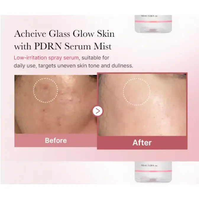 Medicube Pdrn Pink Glutathione Serum Mist