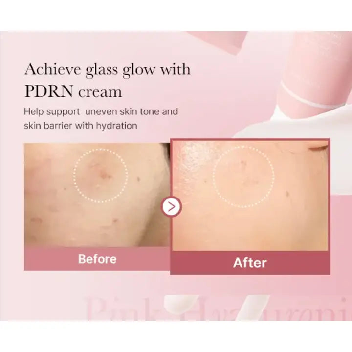 Medicube Pdrn Pink Hyaluronic Moisturizing Cream